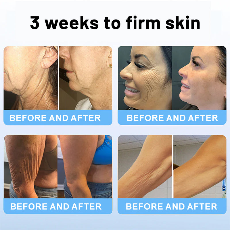 ☘️💖Flysmus™ Collagen Peptides  FIRMING SERUM STICK
