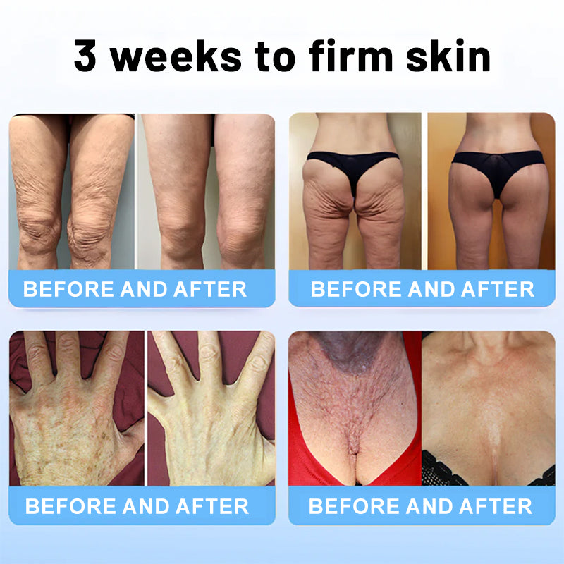 ☘️💖Flysmus™ Collagen Peptides  FIRMING SERUM STICK