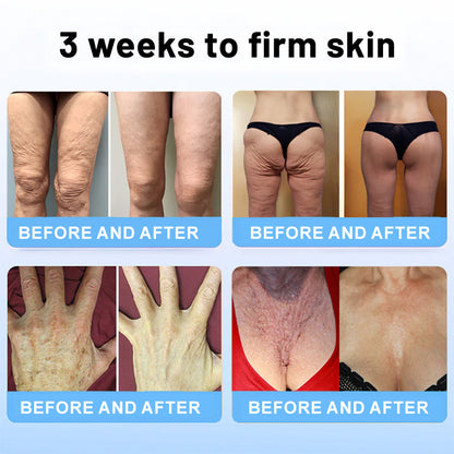 ☘️💖Flysmus™ Collagen Peptides  FIRMING SERUM STICK
